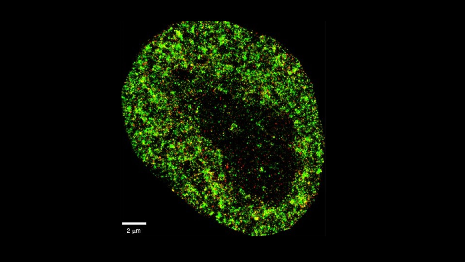 Desarrollan una Inteligencia Artificial capaz de anticipar el diagnóstico de cáncer